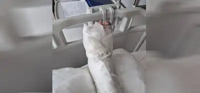 Eylemlerde ezilen ayak fotoğrafının Türkiye’den olmadığı iddiası
