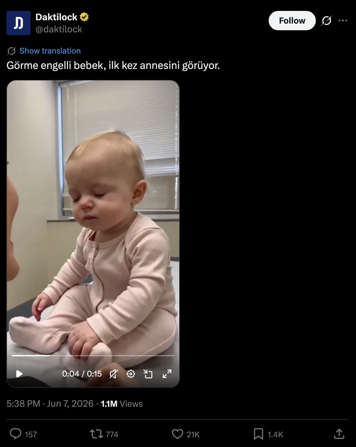 annesini ilk kez goren gorme engelli bebek videosu 1 baceb27f