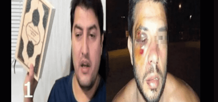 Canlı yayında Kuran yırtan İbrahim Atabey'in dövüldüğü iddia edilen fotoğraf