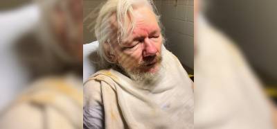 Fotoğrafın Julian Assange’ın işkence gördüğünü gösterdiği iddiası