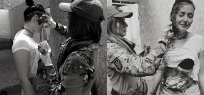Fotoğrafların Ukrayna’daki "sahte" yaralıları gösterdiği iddiası
