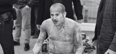Fotoğrafın meclisin önünde kendisini ateşe veren kişiye ait olduğu iddiası